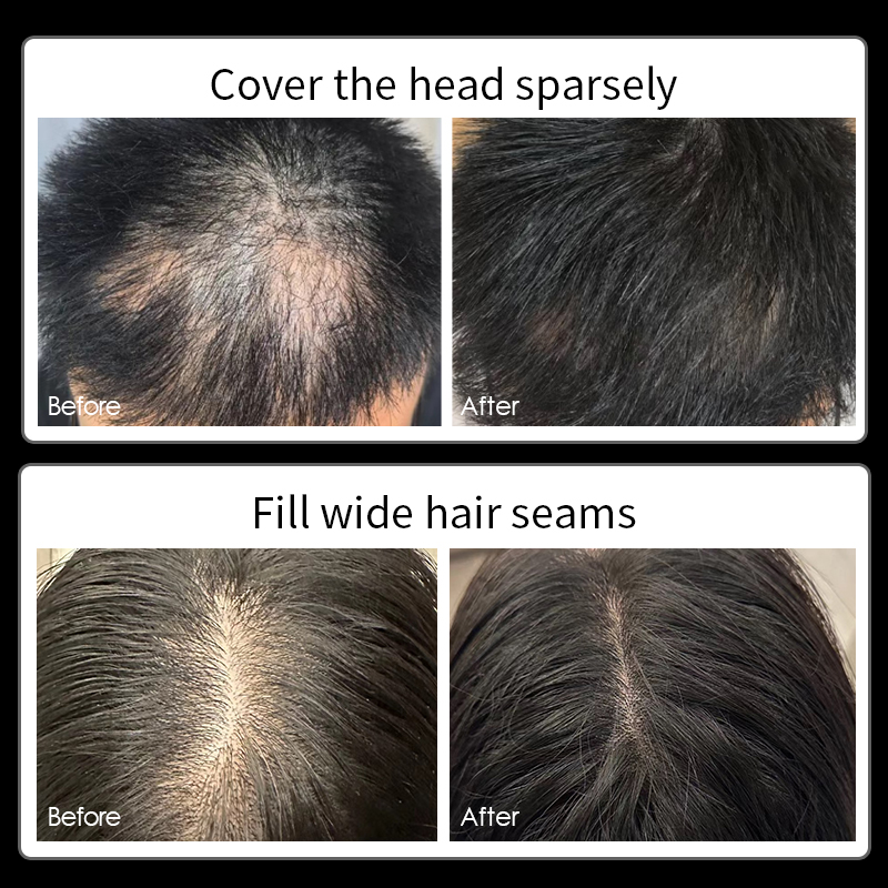 كريم تغطية فراغات الشعر جينزو  - مراجعة Hair Care Lotion وسعره