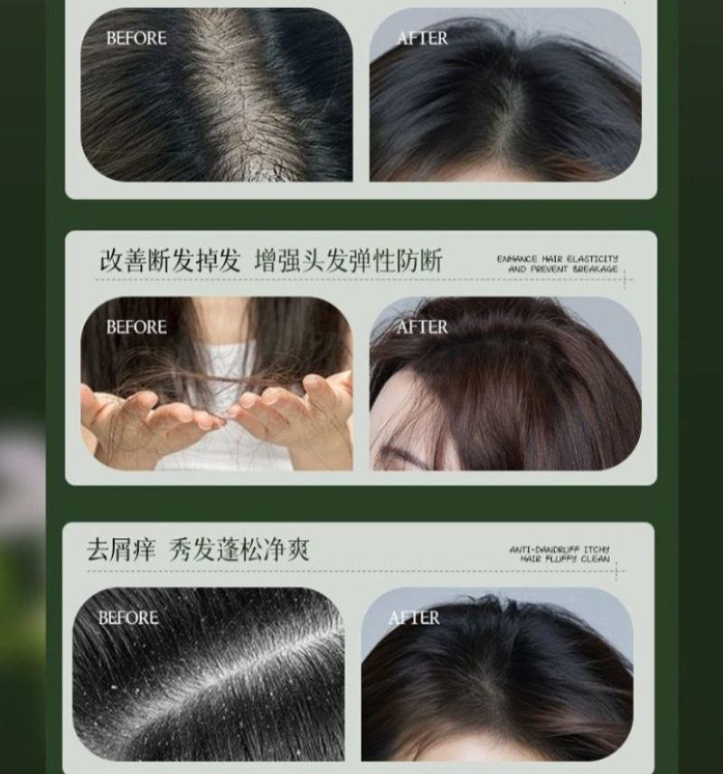 شامبو عشبة أوسمان من أجاك للتح - مراجعة Hair Care Dandruff وسعره