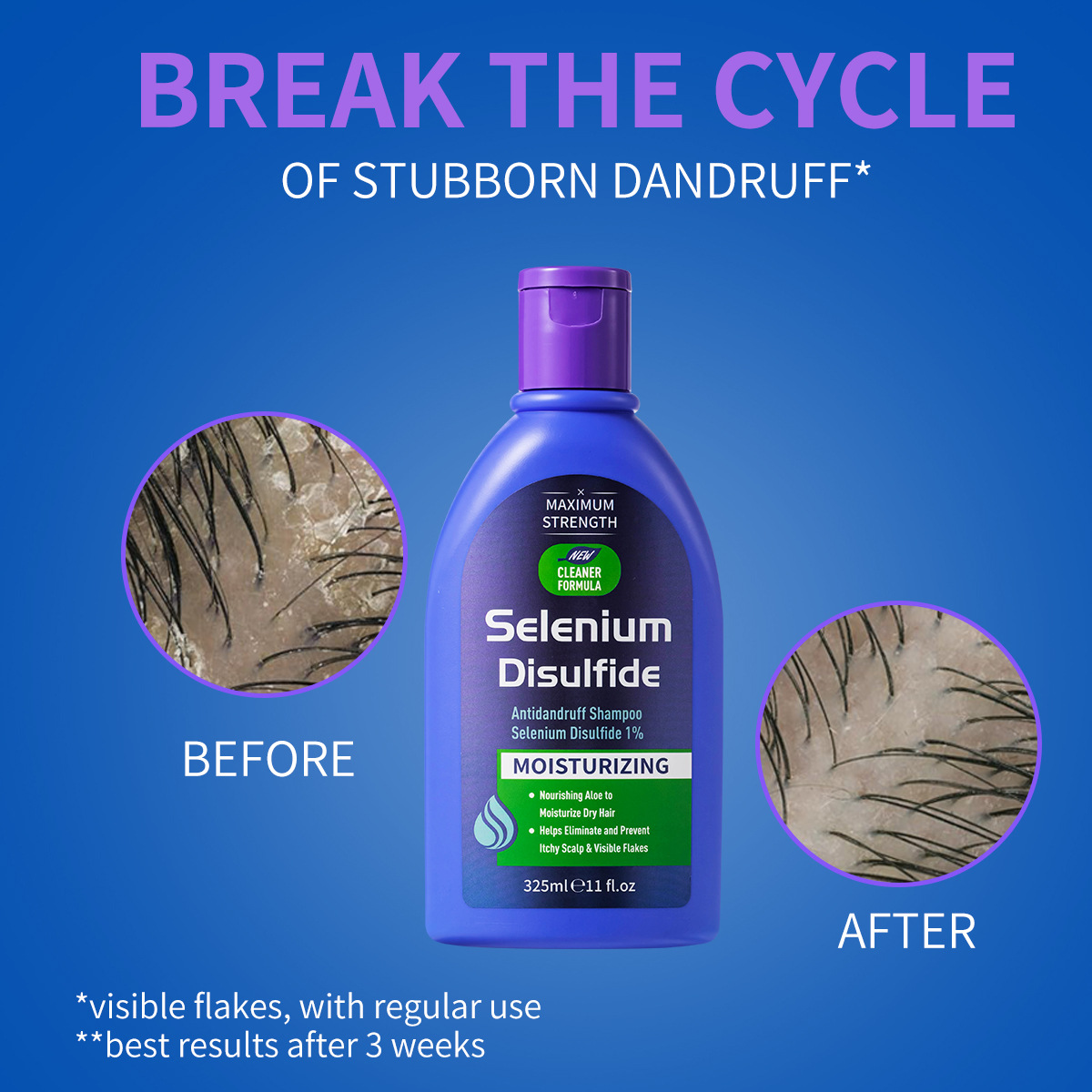 شامبو مضاد للقشرة بثاني كبريتي - مراجعة Hair Care Dandruff وسعره